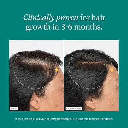 Nutrafol Women Hair Growth Supplements