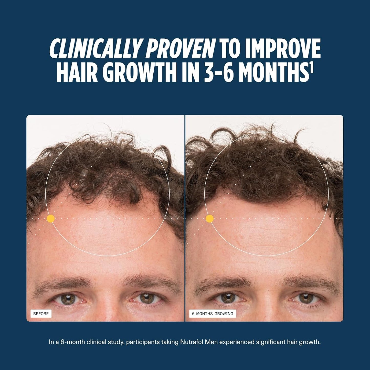Nutrafol Men  Hair Growth Supplements